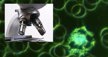 Dunkelfeldmikroskopie in Büren an der Aare Dunkelfeld Blutdiagnostik bei Simply Enjoy